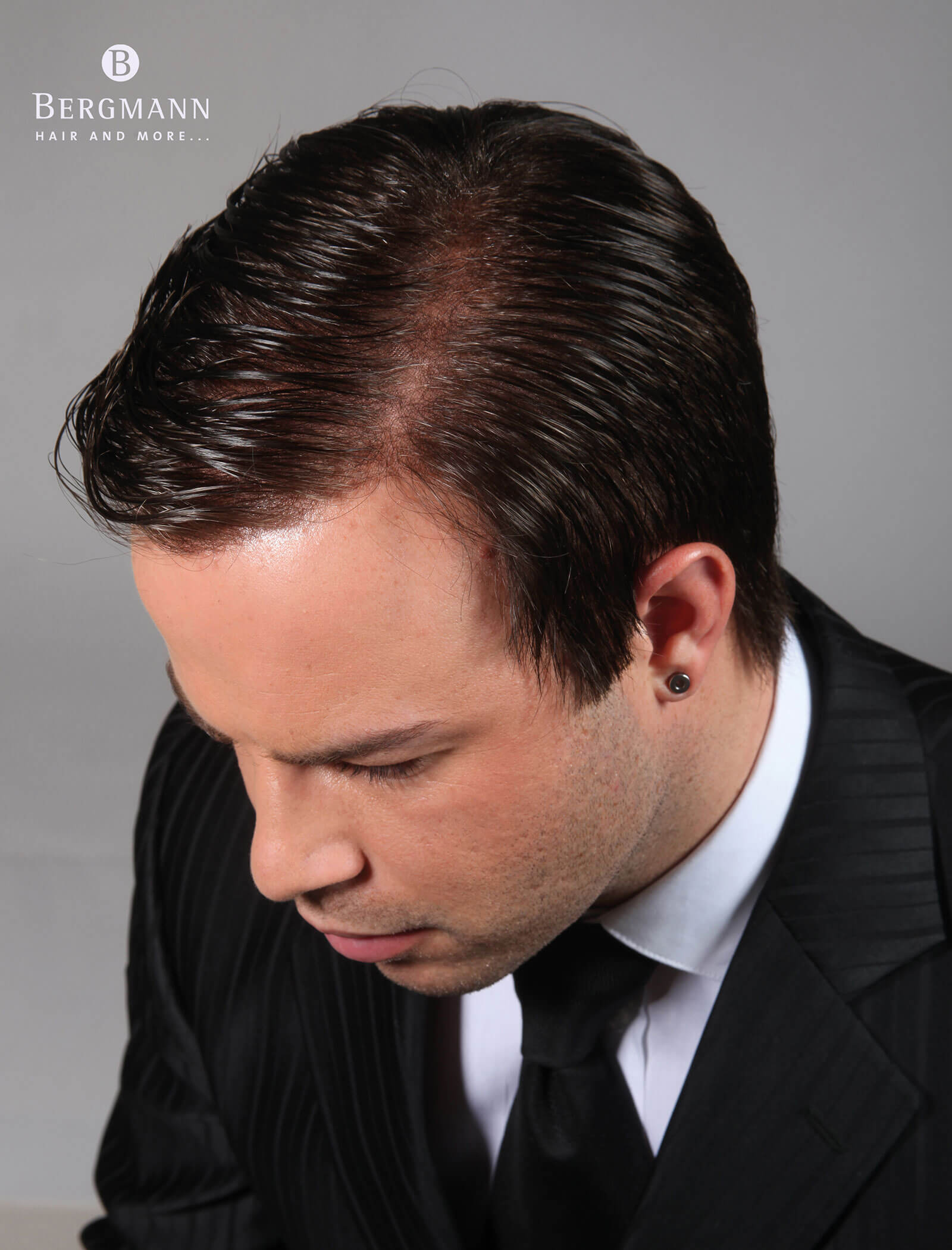Haarverdichtung vorher - Portrait Mann mit dunklen Haaren - Ansicht von oben - Haarstudio Mayr in Bruneck