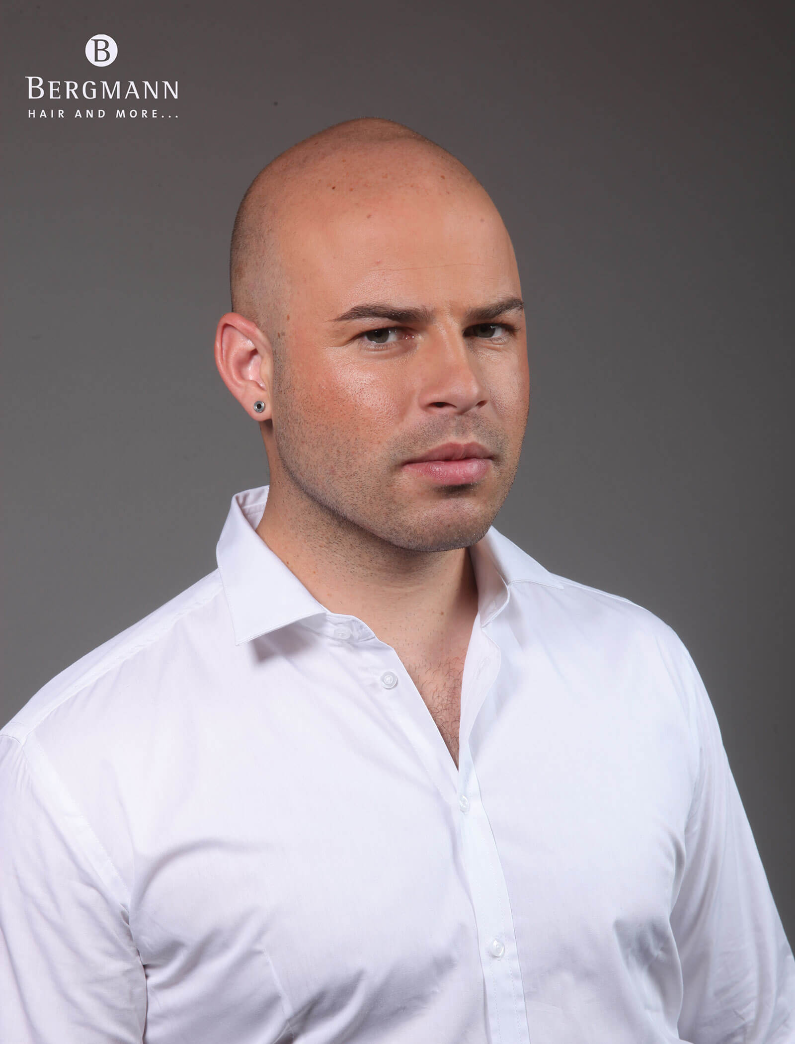 Haarverdichtung vorher - Portrait Mann mit keinen Haaren - Haarstudio Mayr in Bruneck
