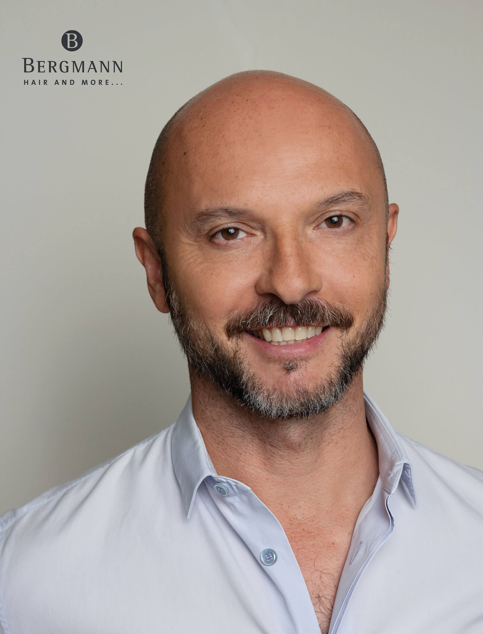 Haarverdichtung vorher - Portrait Mann mit Glatze - Haarstudio Mayr in Bruneck